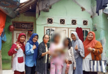 Dinsos Banten Berikan Bantuan ke Bayi Bibir Sumbing Korban Penelantaran Orangtua di Kabupaten Serang